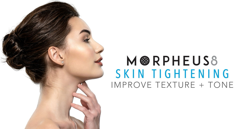 morpheus 8 amsterdam